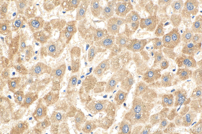 NNT Antibody in Immunohistochemistry (Paraffin) (IHC (P))