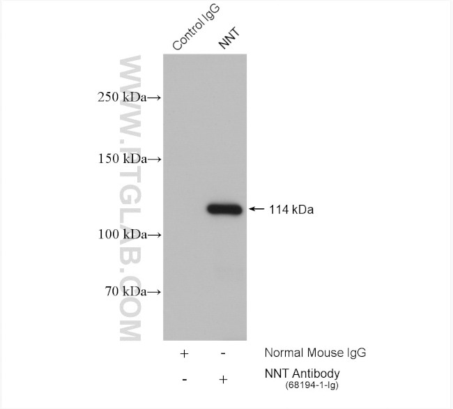 NNT Antibody in Immunoprecipitation (IP)