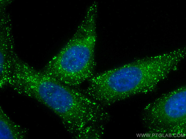 APPL1 Antibody in Immunocytochemistry (ICC/IF)