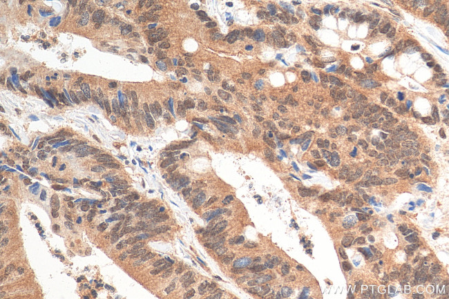 APPL1 Antibody in Immunohistochemistry (Paraffin) (IHC (P))