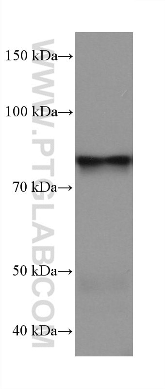 APPL1 Antibody in Western Blot (WB)