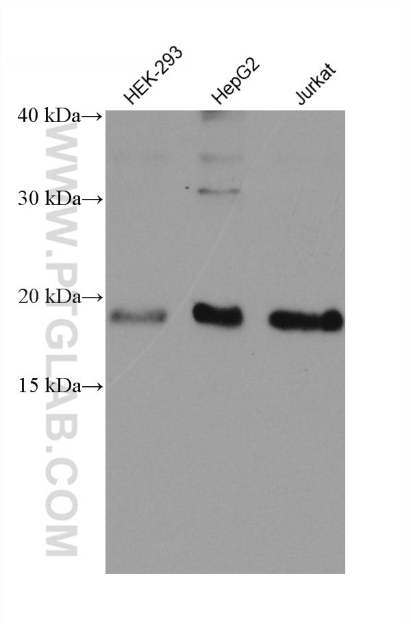 VPS25 Antibody in Western Blot (WB)