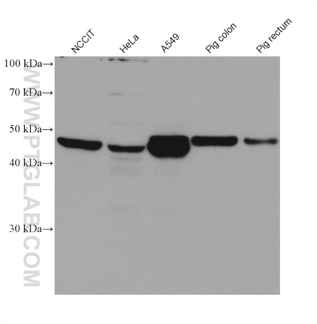 CYP2S1 Antibody in Western Blot (WB)