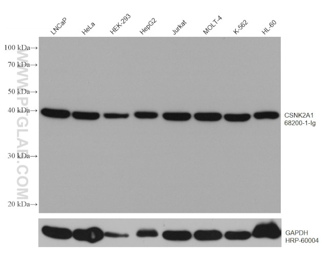 CSNK2A1 Antibody in Western Blot (WB)