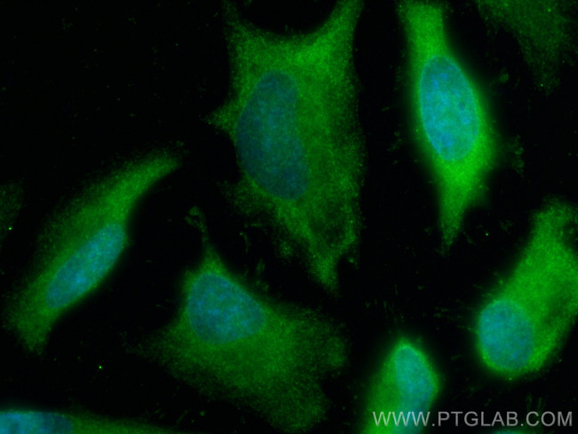 PSMA4 Antibody in Immunocytochemistry (ICC/IF)