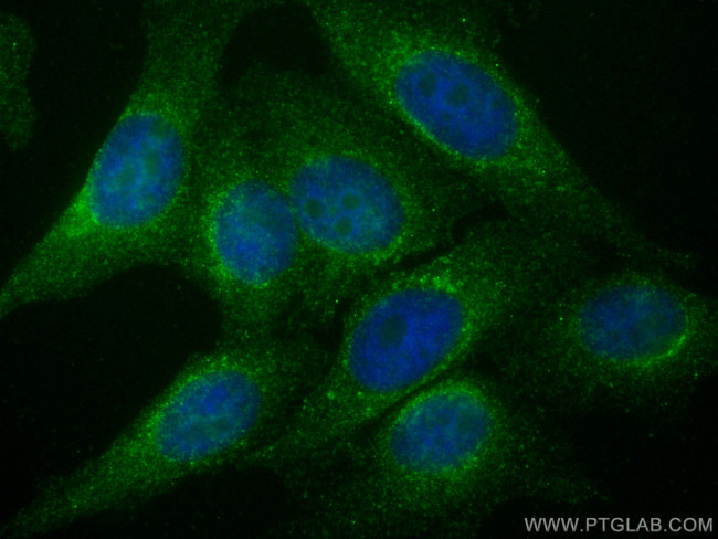 ARF4 Antibody in Immunocytochemistry (ICC/IF)