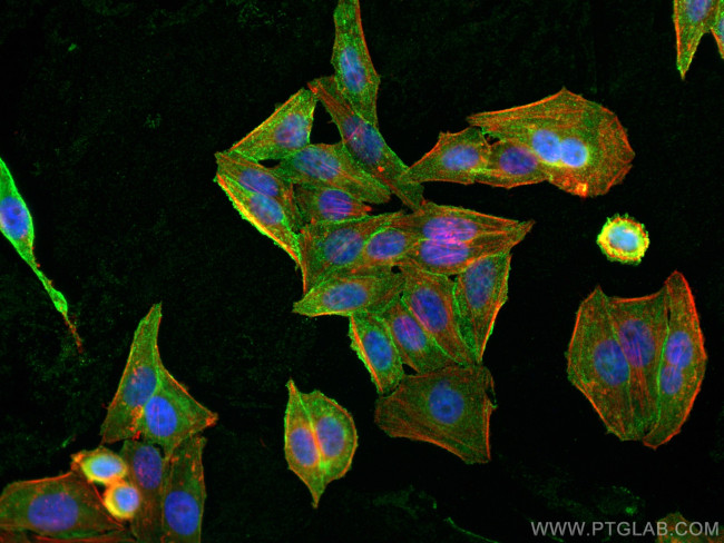 CAP1 Antibody in Immunocytochemistry (ICC/IF)