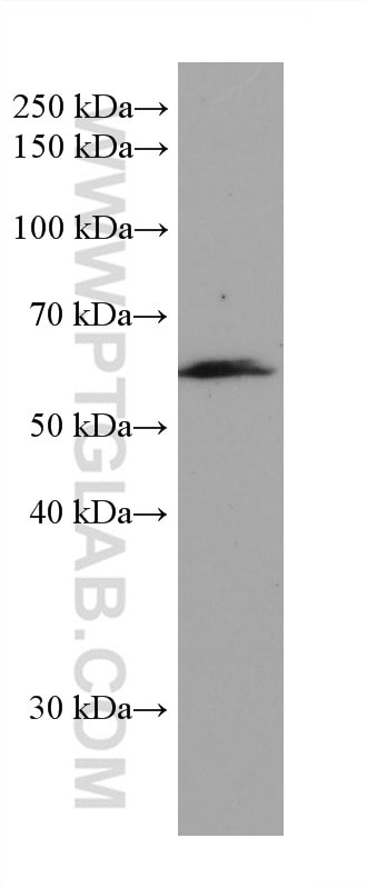 CAP1 Antibody in Western Blot (WB)