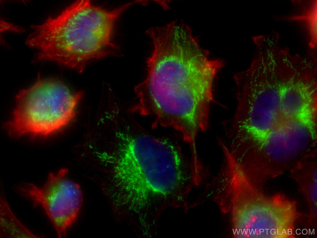 LETM1 Antibody in Immunocytochemistry (ICC/IF)