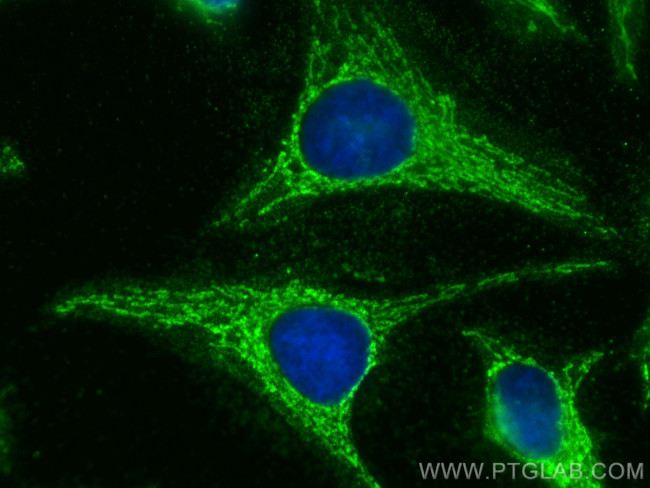 LETM1 Antibody in Immunocytochemistry (ICC/IF)