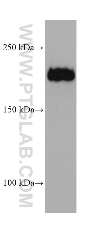 Integrin alpha-1 Antibody in Western Blot (WB)