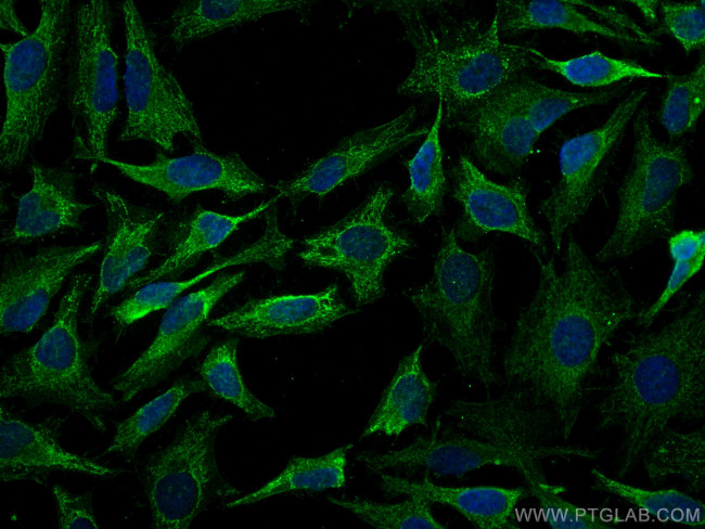 NOTCH2/NOTCH2NL Antibody in Immunocytochemistry (ICC/IF)