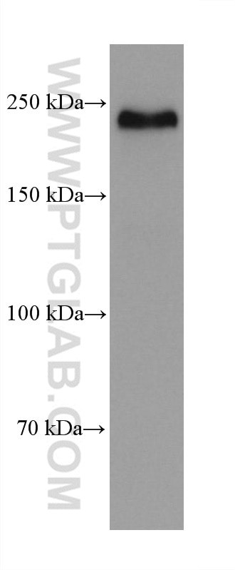 NOTCH2/NOTCH2NL Antibody in Western Blot (WB)