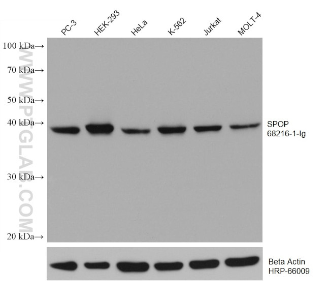 SPOP Antibody in Western Blot (WB)