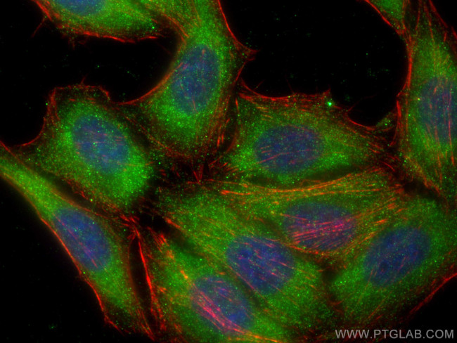 eRF3a/GSPT1 Antibody in Immunocytochemistry (ICC/IF)