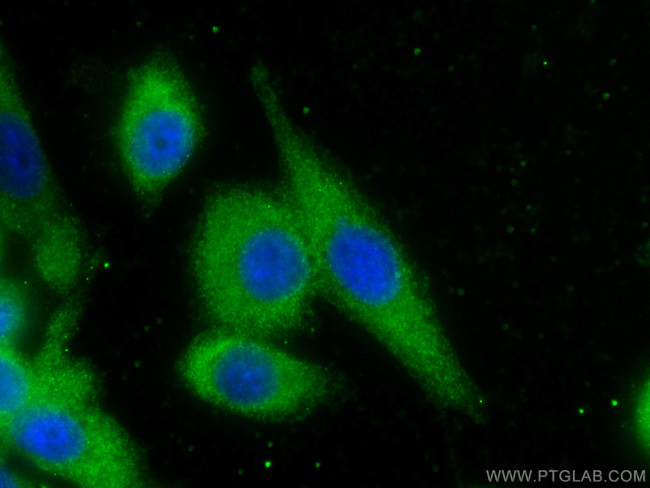 eRF3a/GSPT1 Antibody in Immunocytochemistry (ICC/IF)