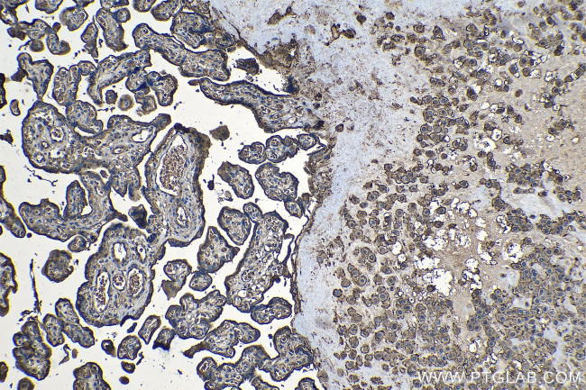 CD59 Antibody in Immunohistochemistry (Paraffin) (IHC (P))