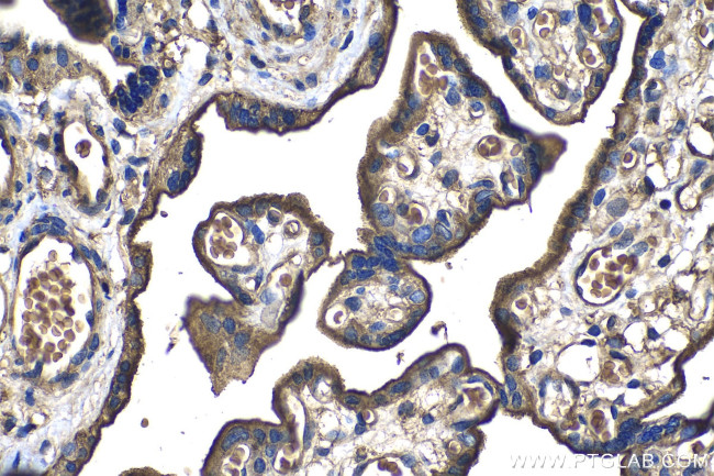 CD59 Antibody in Immunohistochemistry (Paraffin) (IHC (P))