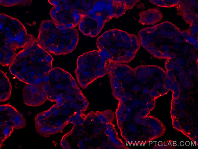 CD59 Antibody in Immunohistochemistry (PFA fixed) (IHC (PFA))