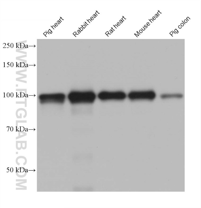 ACTN2 Antibody in Western Blot (WB)