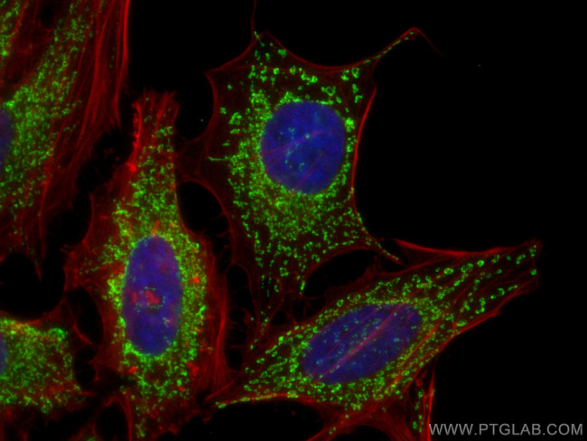 IMMT Antibody in Immunocytochemistry (ICC/IF)