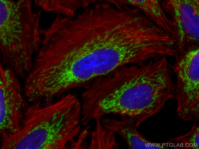 IMMT Antibody in Immunocytochemistry (ICC/IF)