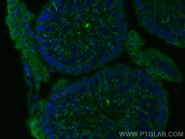 PGK2 Antibody in Immunohistochemistry (PFA fixed) (IHC (PFA))