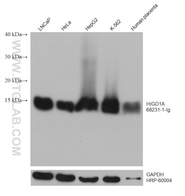 HIGD1A Antibody in Western Blot (WB)