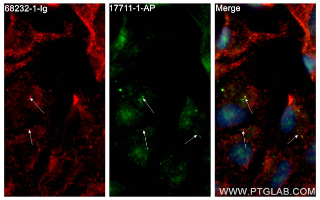 TTC30A Antibody in Immunocytochemistry (ICC/IF)