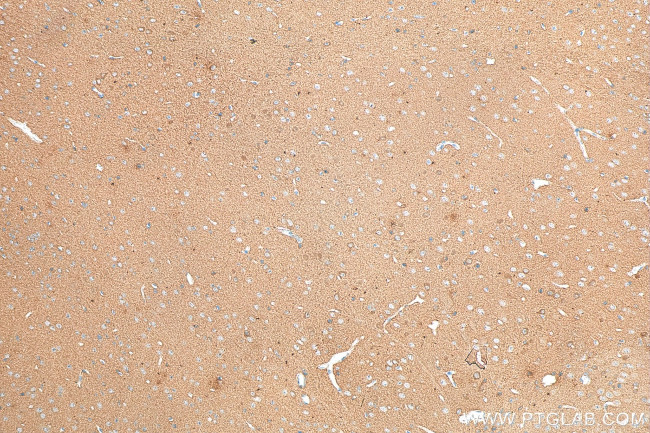 DCLK1 Antibody in Immunohistochemistry (Paraffin) (IHC (P))