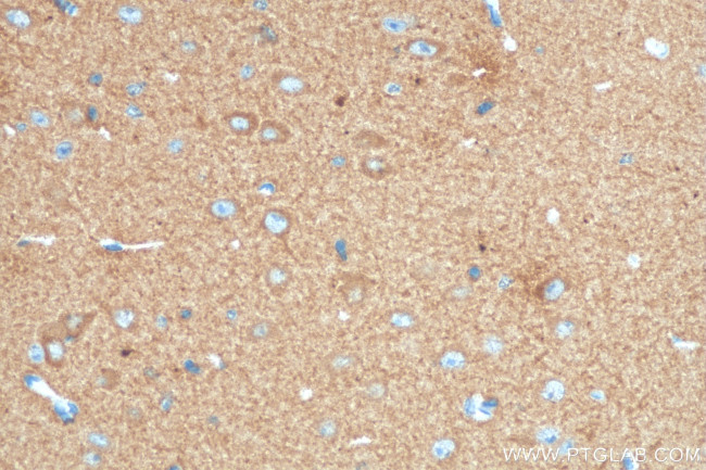 DCLK1 Antibody in Immunohistochemistry (Paraffin) (IHC (P))