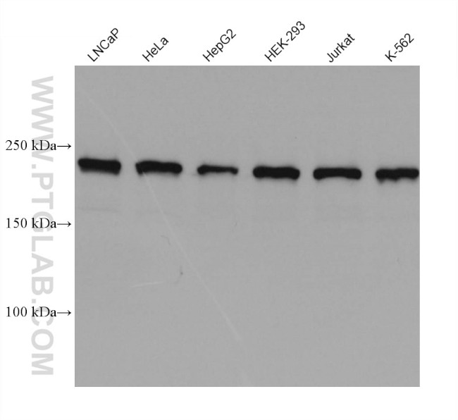 KIAA1429 Antibody in Western Blot (WB)