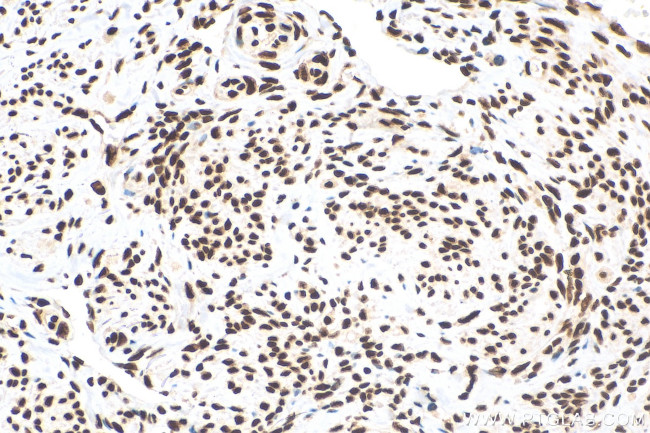 HNRNPD Antibody in Immunohistochemistry (Paraffin) (IHC (P))