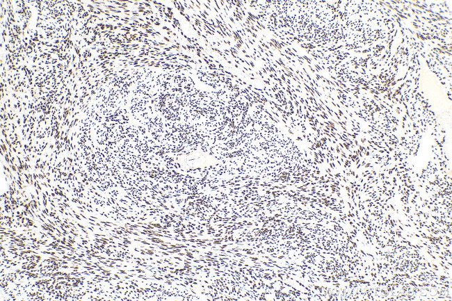 HNRNPD Antibody in Immunohistochemistry (Paraffin) (IHC (P))