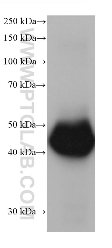 ALDH2 Antibody in Western Blot (WB)