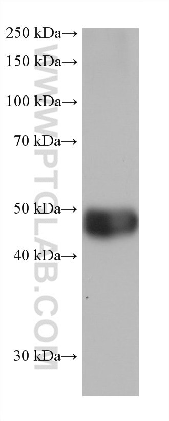 ALDH2 Antibody in Western Blot (WB)