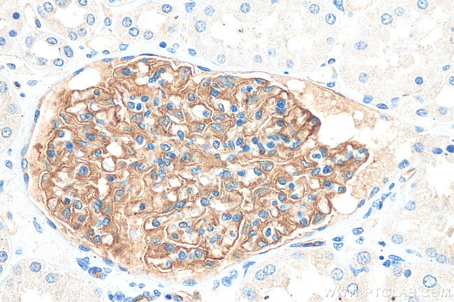 Podocalyxin Antibody in Immunohistochemistry (Paraffin) (IHC (P))