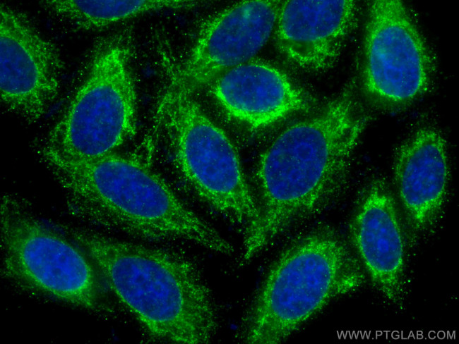 NDUFS1 Antibody in Immunocytochemistry (ICC/IF)