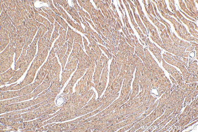 NDUFS1 Antibody in Immunohistochemistry (Paraffin) (IHC (P))