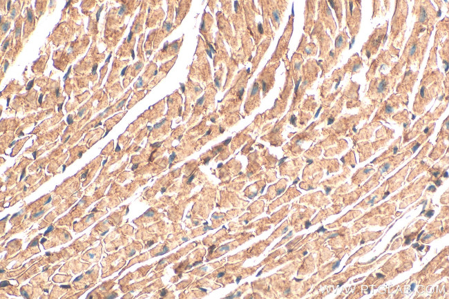 NDUFS1 Antibody in Immunohistochemistry (Paraffin) (IHC (P))