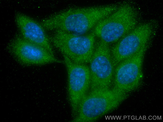 ABL1 Antibody in Immunocytochemistry (ICC/IF)