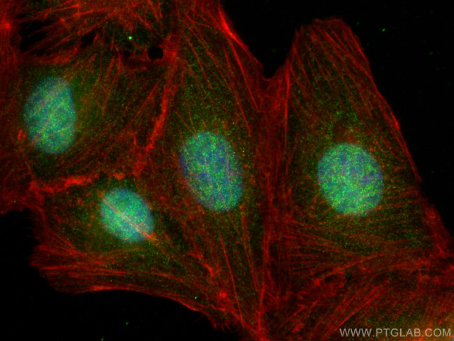 ABL1 Antibody in Immunocytochemistry (ICC/IF)