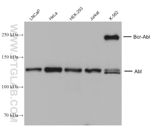 ABL1 Antibody in Western Blot (WB)