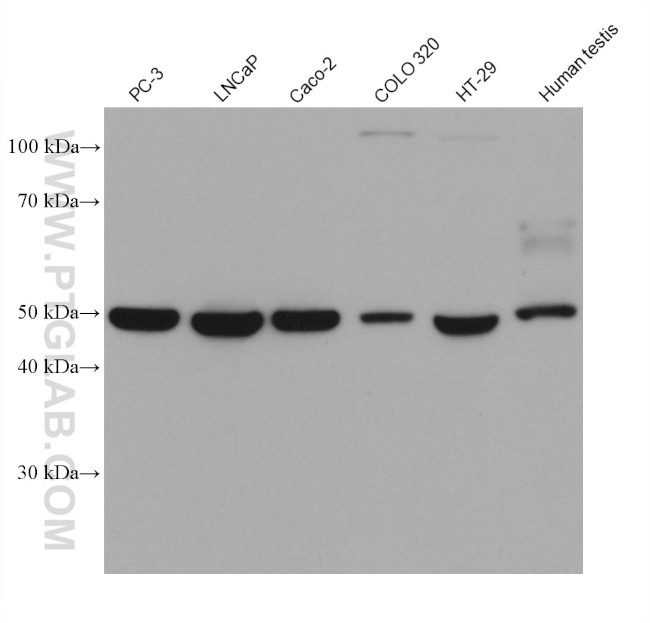 TMPRSS2 Antibody in Western Blot (WB)