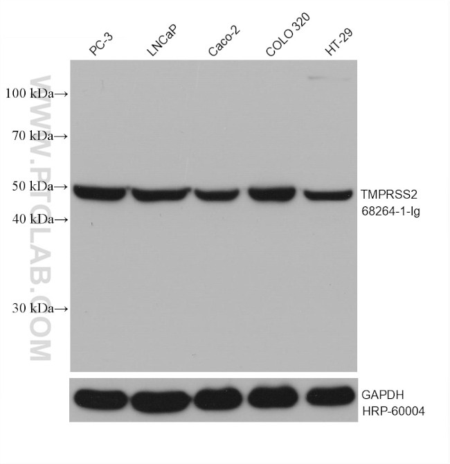 TMPRSS2 Antibody in Western Blot (WB)