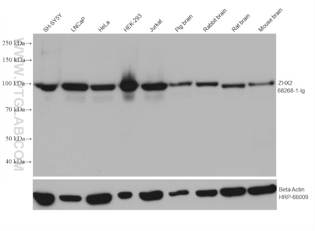 ZHX2 Antibody in Western Blot (WB)