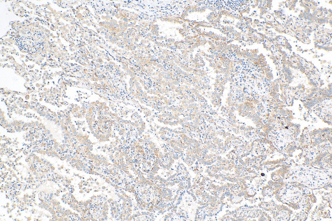 MAP4 Antibody in Immunohistochemistry (Paraffin) (IHC (P))