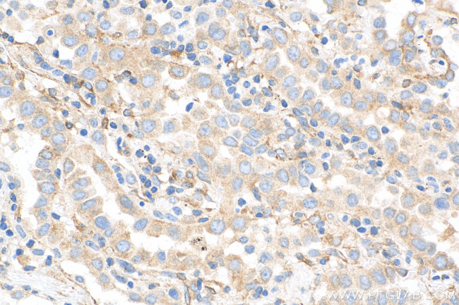 MAP4 Antibody in Immunohistochemistry (Paraffin) (IHC (P))