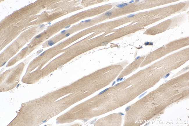 SCN5A Antibody in Immunohistochemistry (Paraffin) (IHC (P))