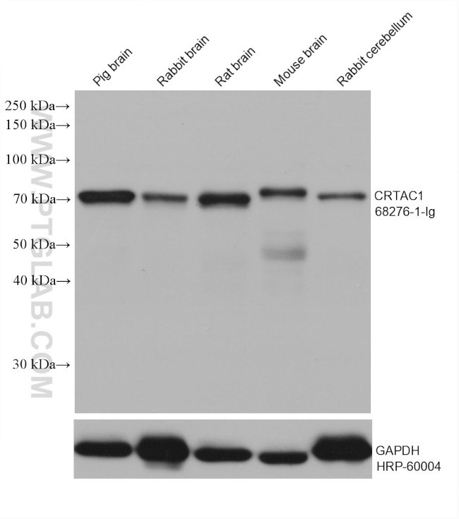 CRTAC1 Antibody in Western Blot (WB)